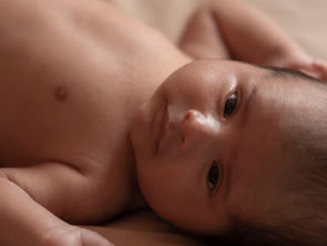 Torticollis and Flat Spots: How They're Connected (and What Parents Can Do)