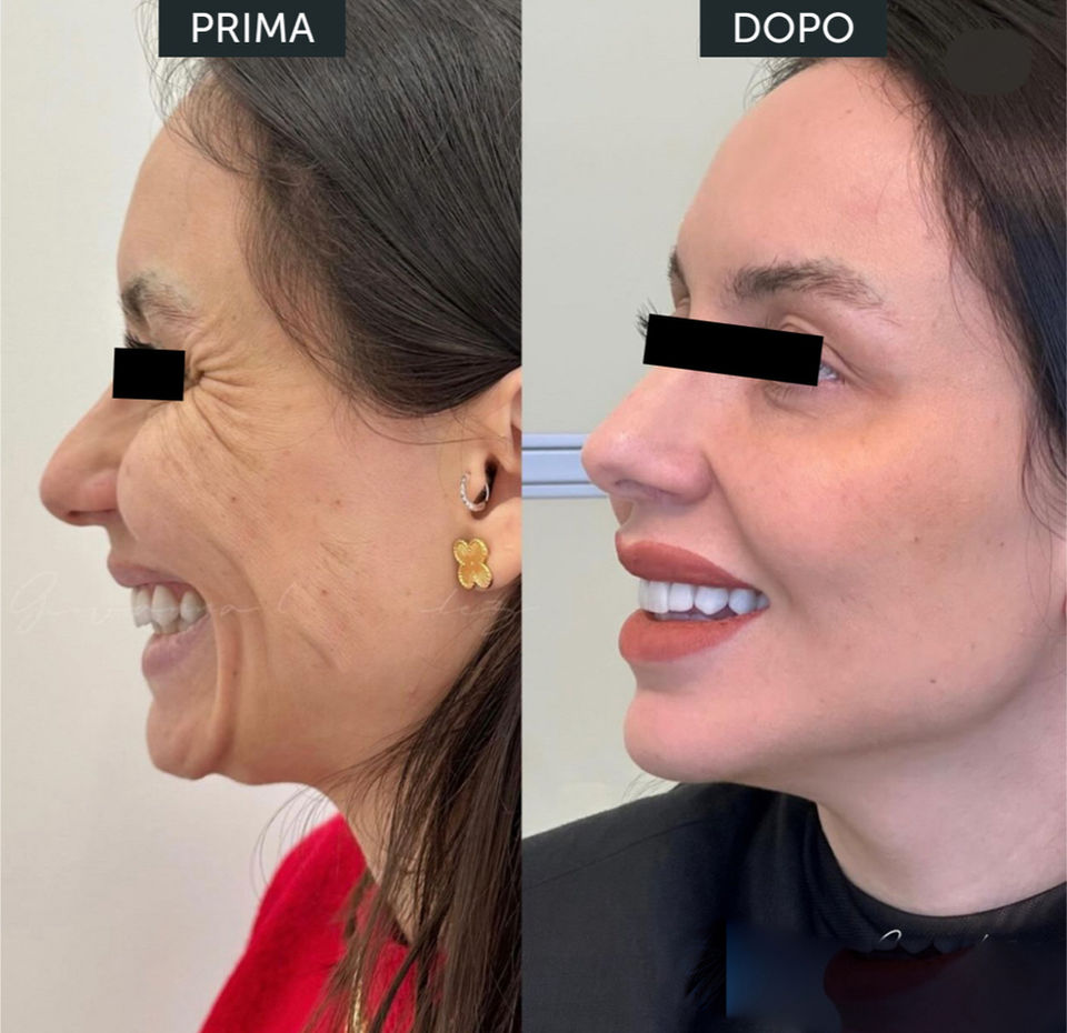 prima/dopo medicina estetica e cure dentali