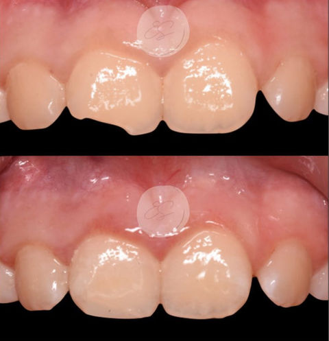 prima/dopo cure dentali