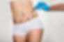 abdominoplastie