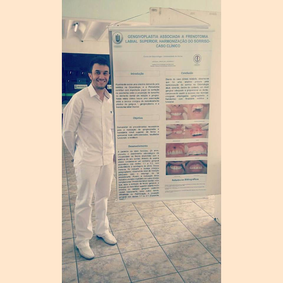 GENGIVOPLASTIA