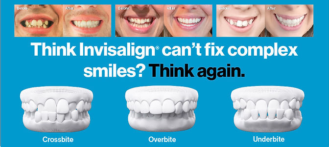 Invisalign- Banners Source File.jpeg