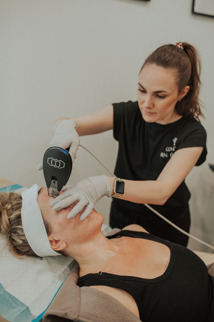 Morpheus8 procedure in eagle mountain