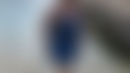 Can I still travel now that I am an amputee?