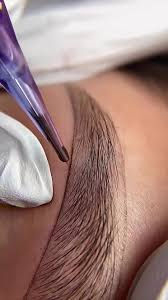 How does pigment heal in the skin?