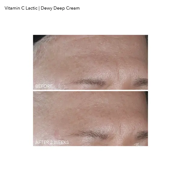 Thumbnail: Vitamin C Lactic Dewy Deep Cream