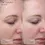 Thumbnail: Bio Complete Serum