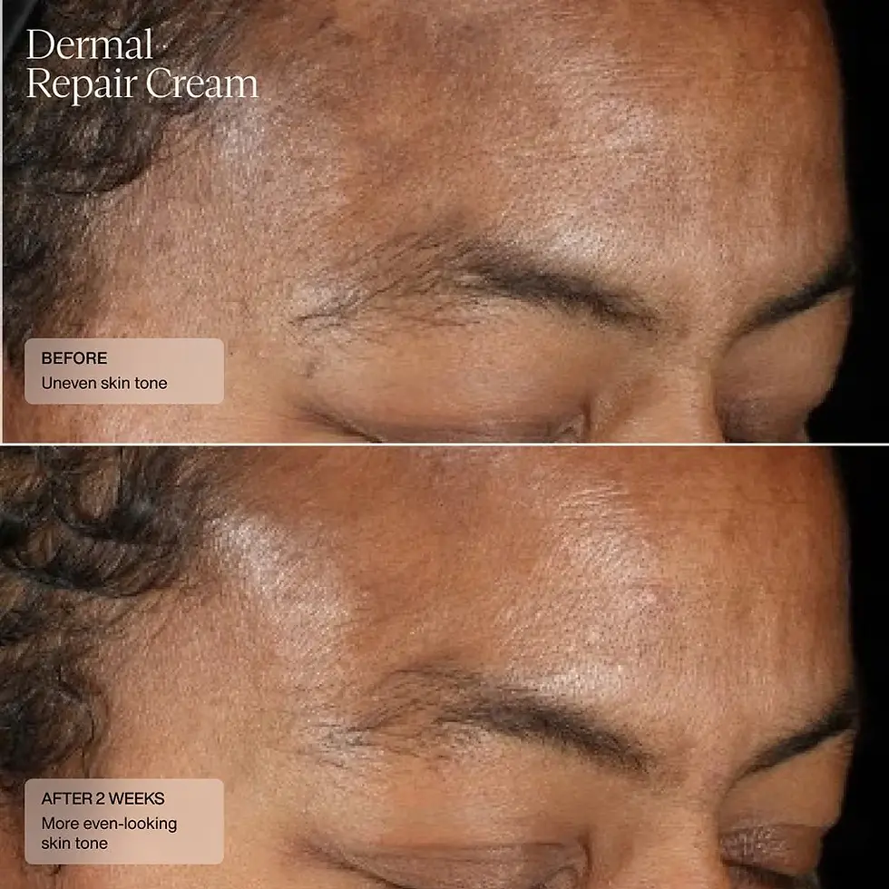 Thumbnail: Dermal Repair Cream