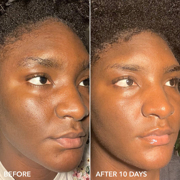 Thumbnail: C + Collagen™ Brighten & Firm Vitamin C Serum