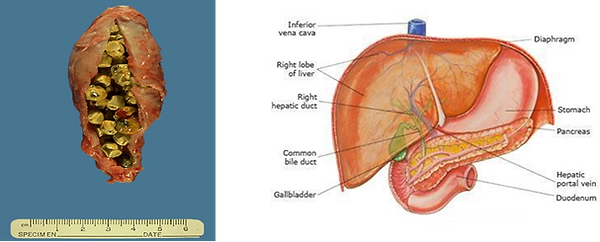 The Liver and Gallbladder