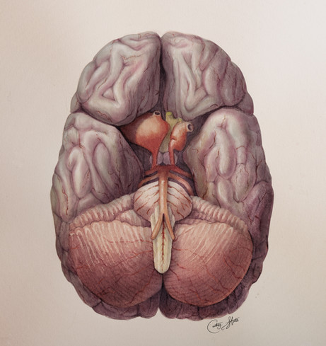 Pathology of Brain.jpg