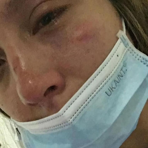 Tras publicaciones realizadas en redes sobre caso de lesiones a una mujer Policía Tunja se pronunció