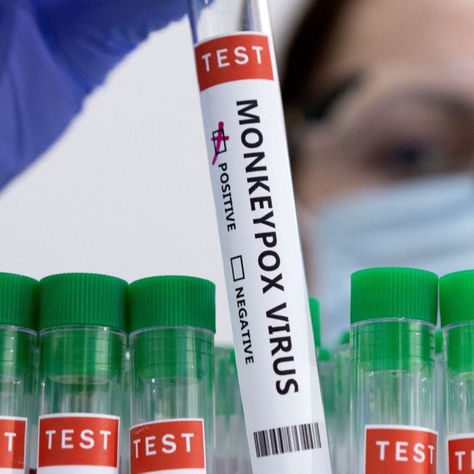 Viruela del mono viene creciendo en Colombia: Minsalud