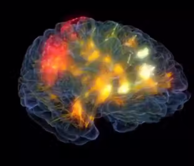 brain1.avif