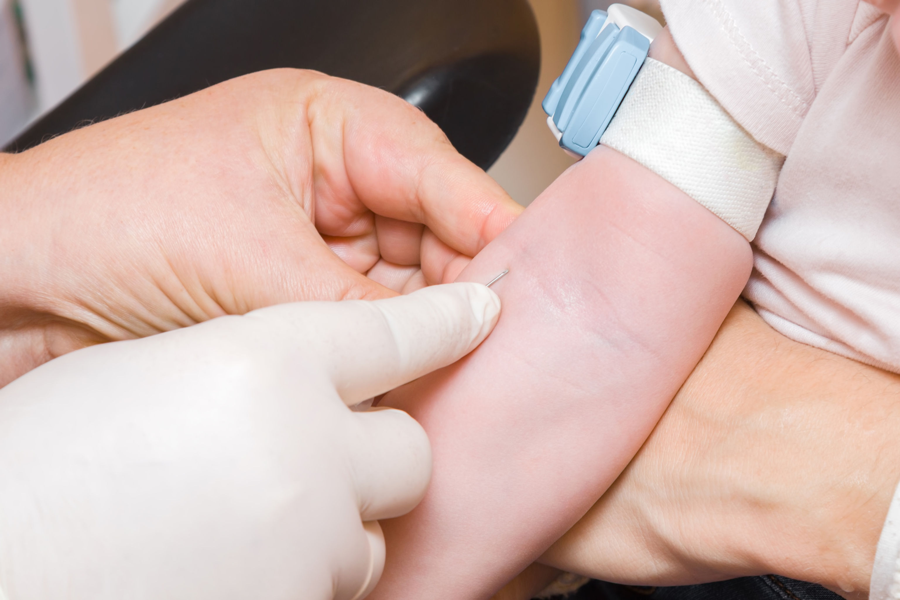 Pediatric Blood Draws/Heel Stick