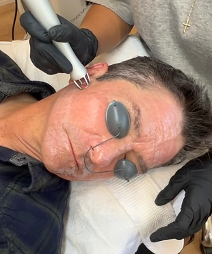 View recent photos (2).png