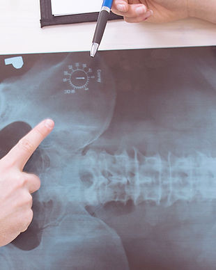 X-Ray Results