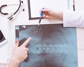 X-Ray Risultati