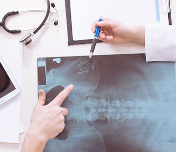 X-Ray Results