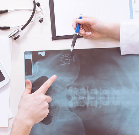 Médicos que revisan las radiografías