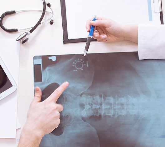 Doctors reviewing X-ray