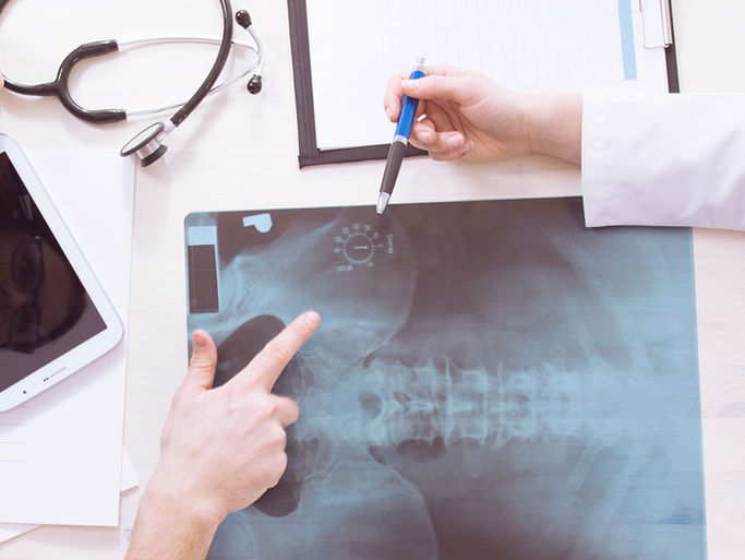 Overhead view of three people looking at an xray