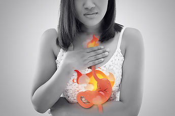 Acidity/Gas/GERD/Reflux-Consult your Gastroenterologist