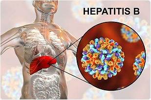Hepatitis B affects Liver-Consult your Gastroenterologist.