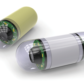 Capsule Endoscopy | Dr Amit Bhasin | Gastroenterologist