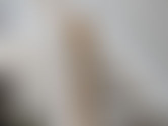 What Can a Slip & Fall Attorney Do for Me?