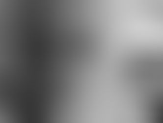 Nursing Home Head Injury Lawsuits: What You Need to Know