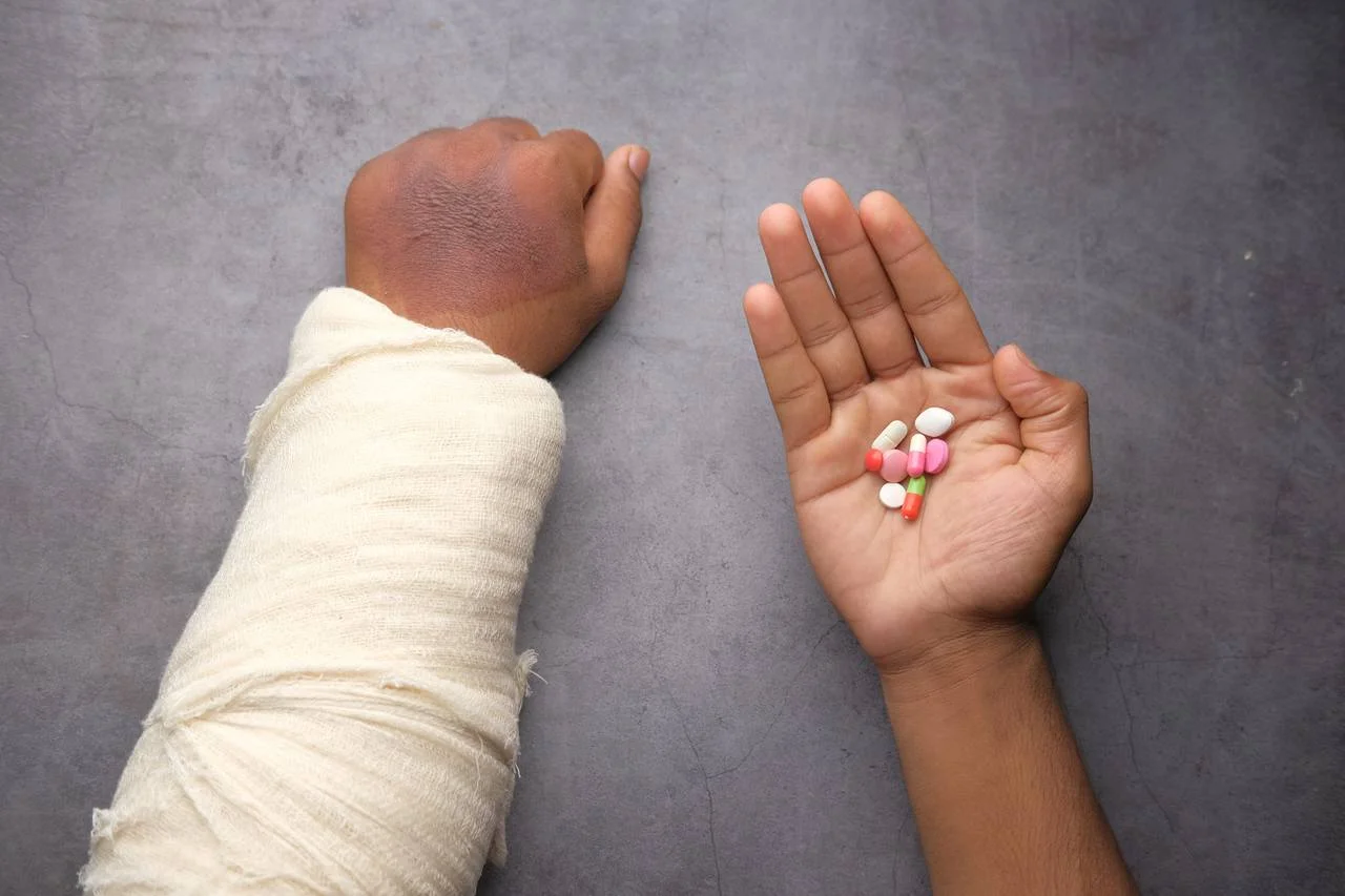 hand in cast and hand with pills