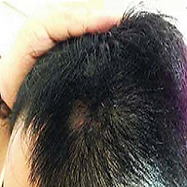 After 1 week