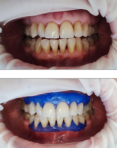 clincia dental villa alemana 