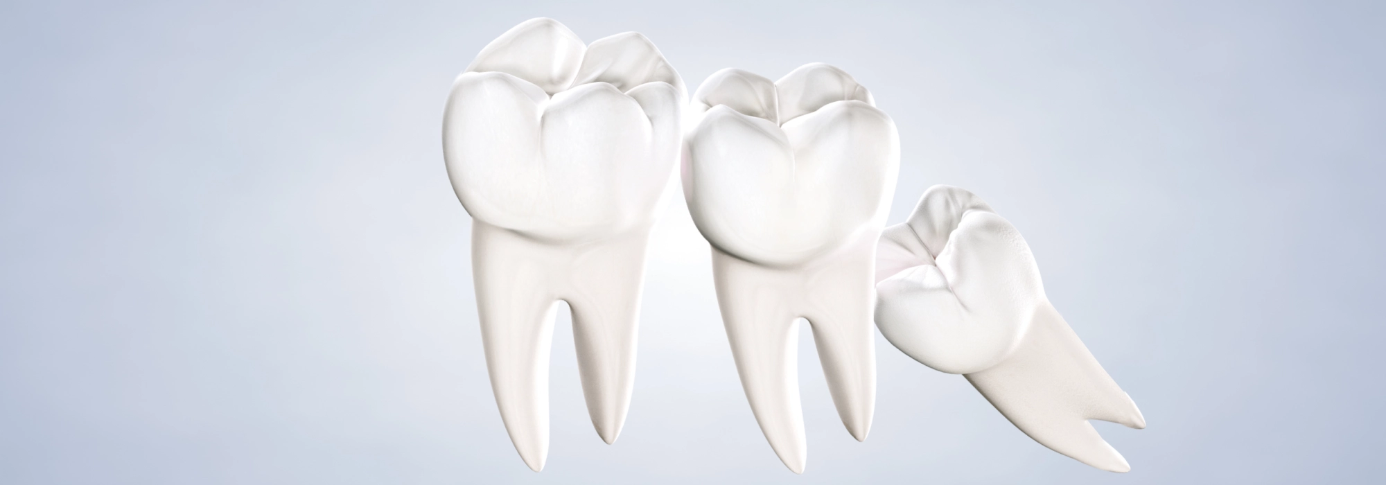 wisdom-teeth-landscape.webp