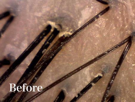 頭皮のオイルマッサージ