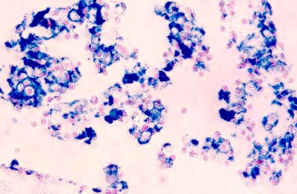 Prussian Blue Stain