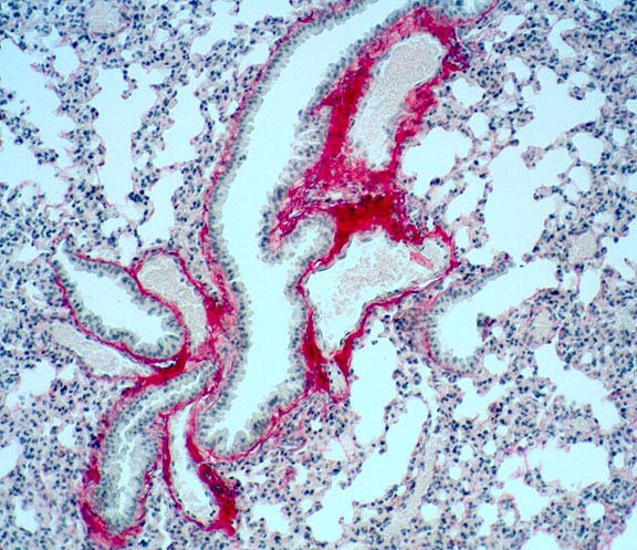 Sirius Red Stain