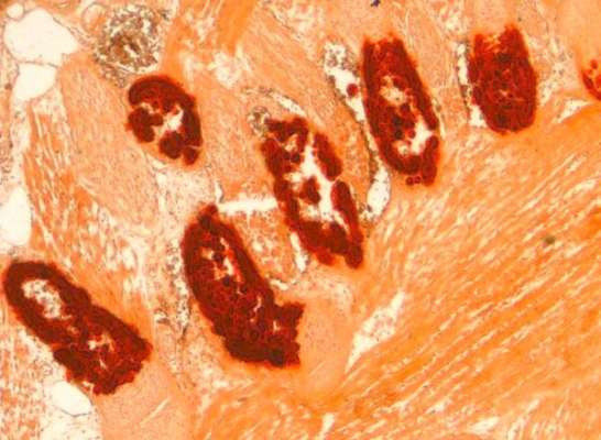 Alizarin Red Stain Kit