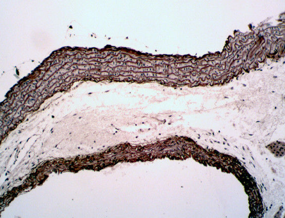 Orcein Elastin Stain