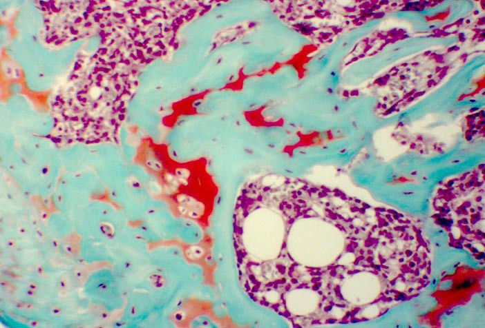Safranin O Stain