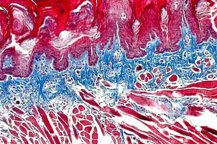 Masson Trichrome Stain