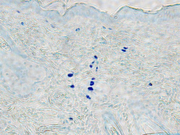 Toluidine Blue Stain Kit