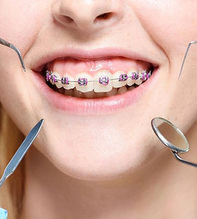 orthodontics 2.jpg