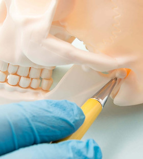 Bone grafting.jpeg