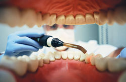 enfermedad periodontal