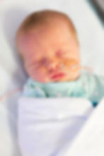 Infant born preterm being fed by a feeding tube