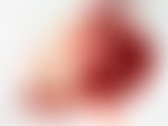 Gastric Balloon