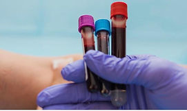 Blood Tubes.jpg
