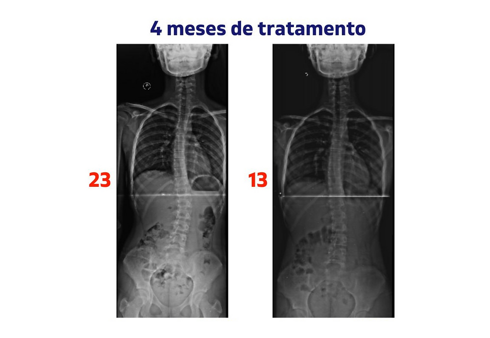 Abordagem SEAS 1 vez por semana